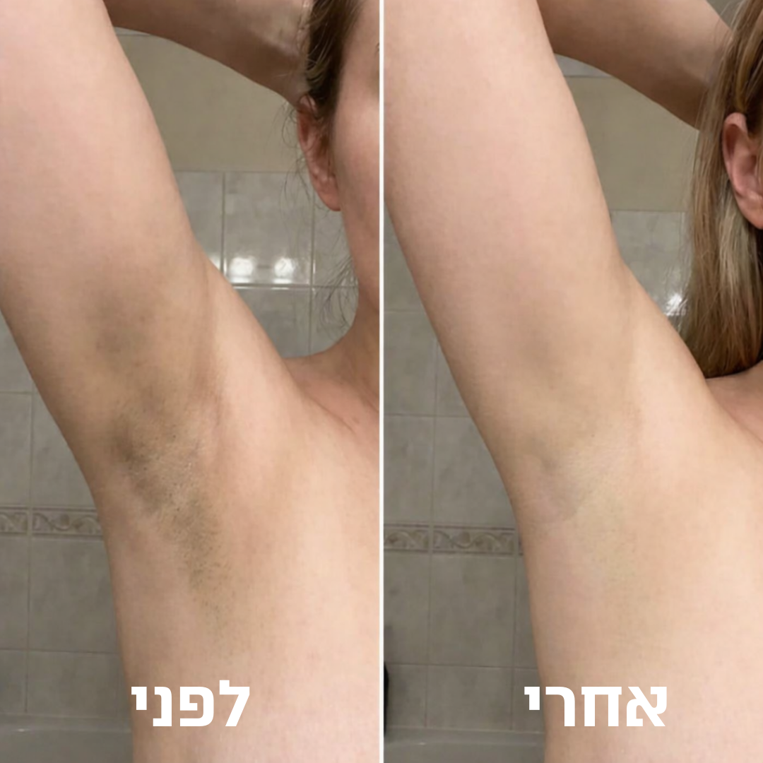 פולאר פילינג