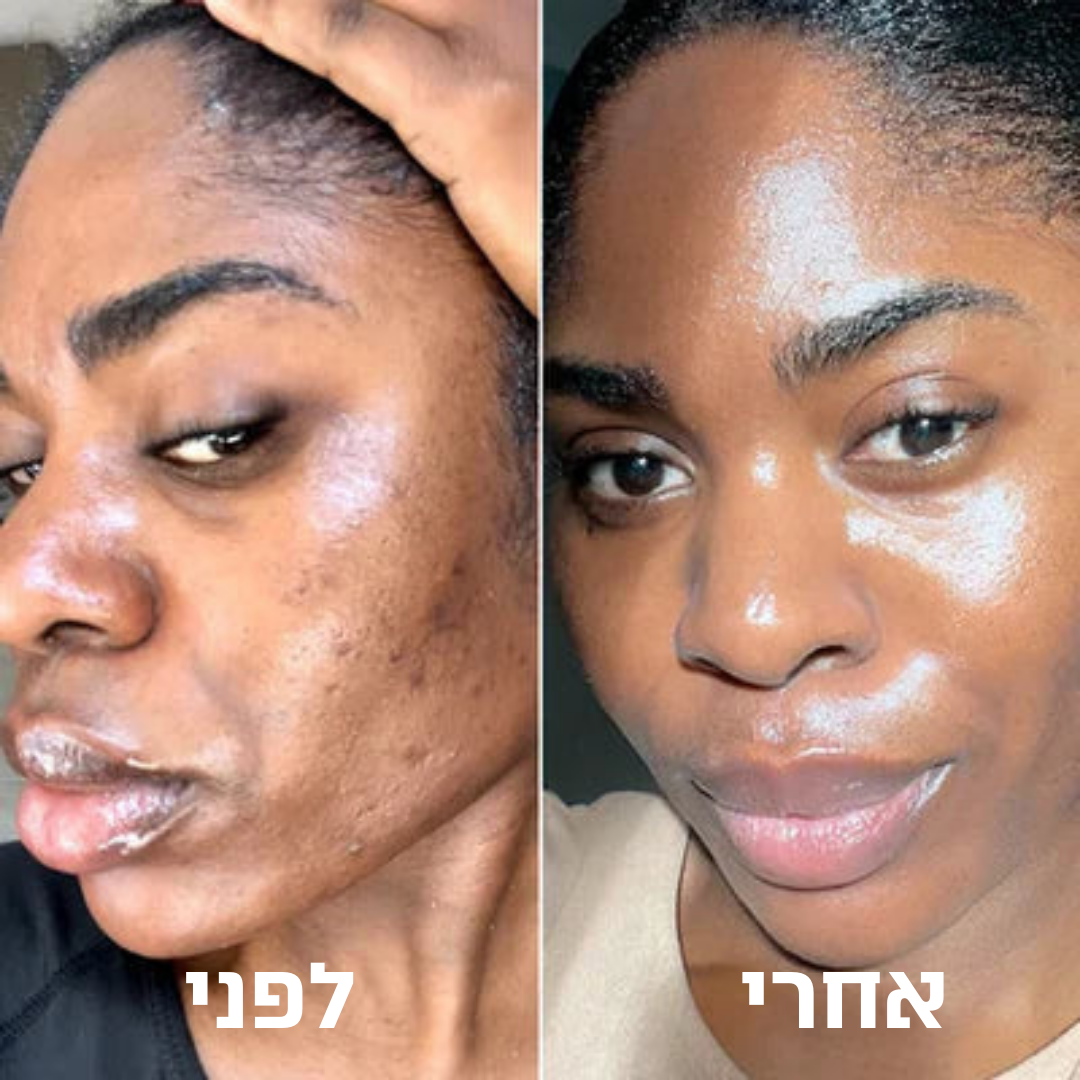 פולאר פילינג