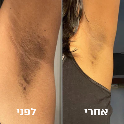 פולאר פילינג